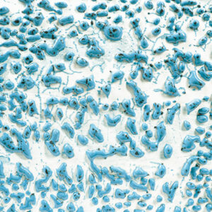 CR-22 Speckled Teal